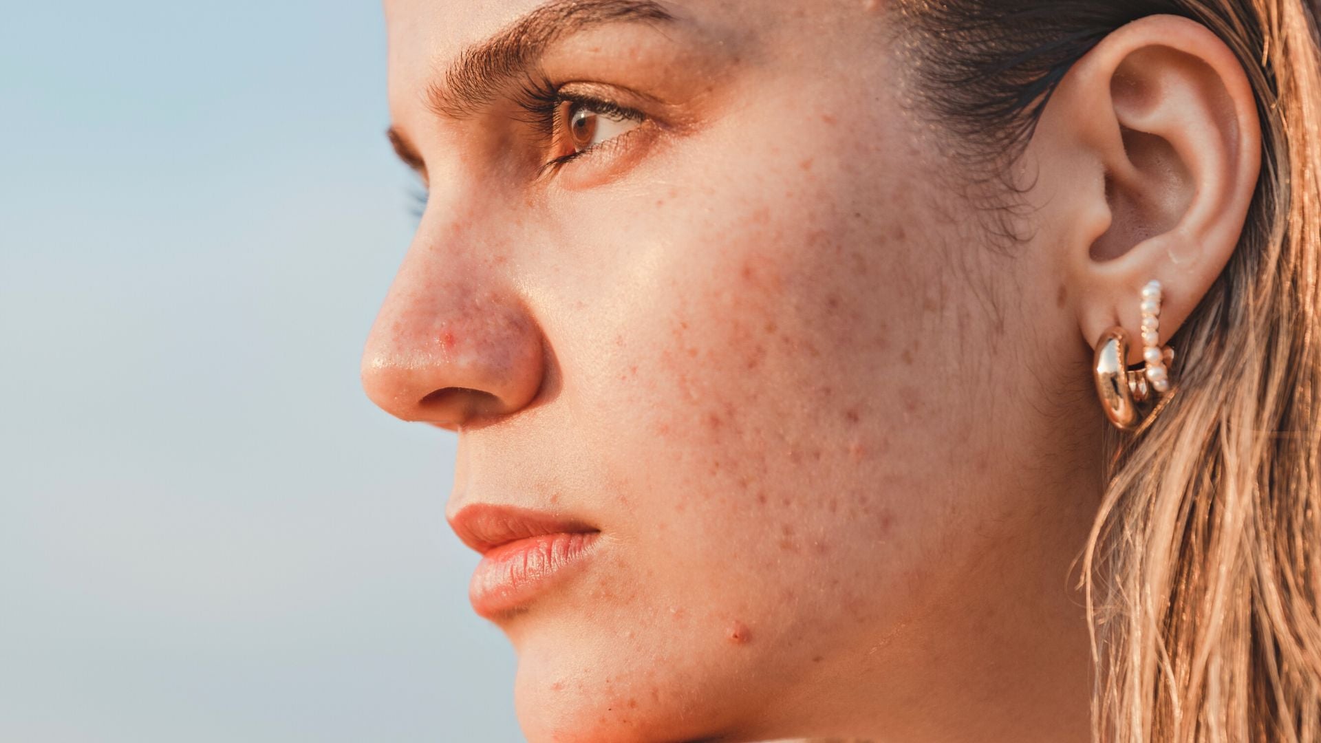 how-the-sun-affects-your-skin-effective-skin-care-products-medical